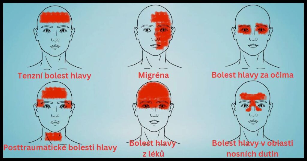 bolest hlavy